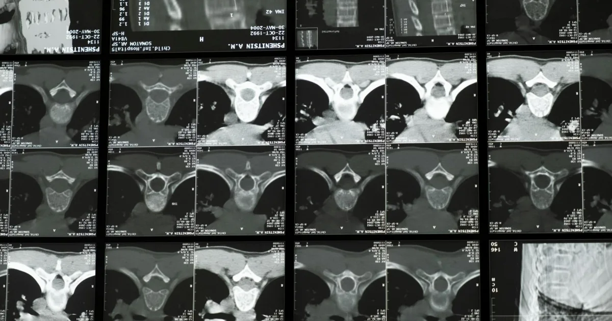 Downtown Plymouth, CT, CT